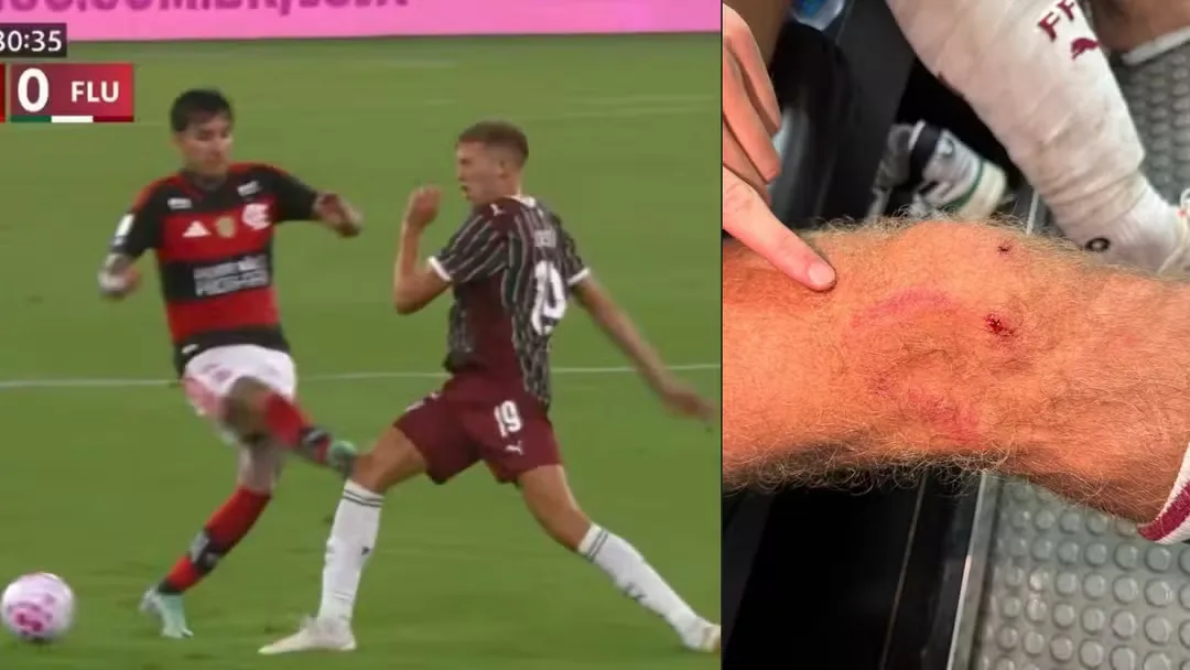 Fluminense critica arbitragem de Fla-Flu em nota oficial e mostra foto de joelho de Castillo após entrada de Pulgar